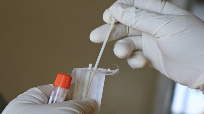 Le test PCR n’est plus obligatoire pour confirmer un test antigénique positif